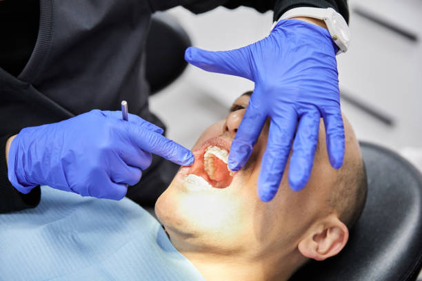 Best Emergency Broken Tooth Repair in Camden, TN