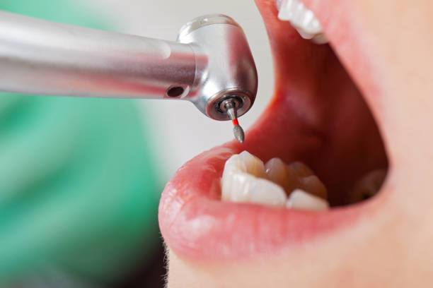 Best Emergency Dental Care for Trauma or Injury in Camden, TN